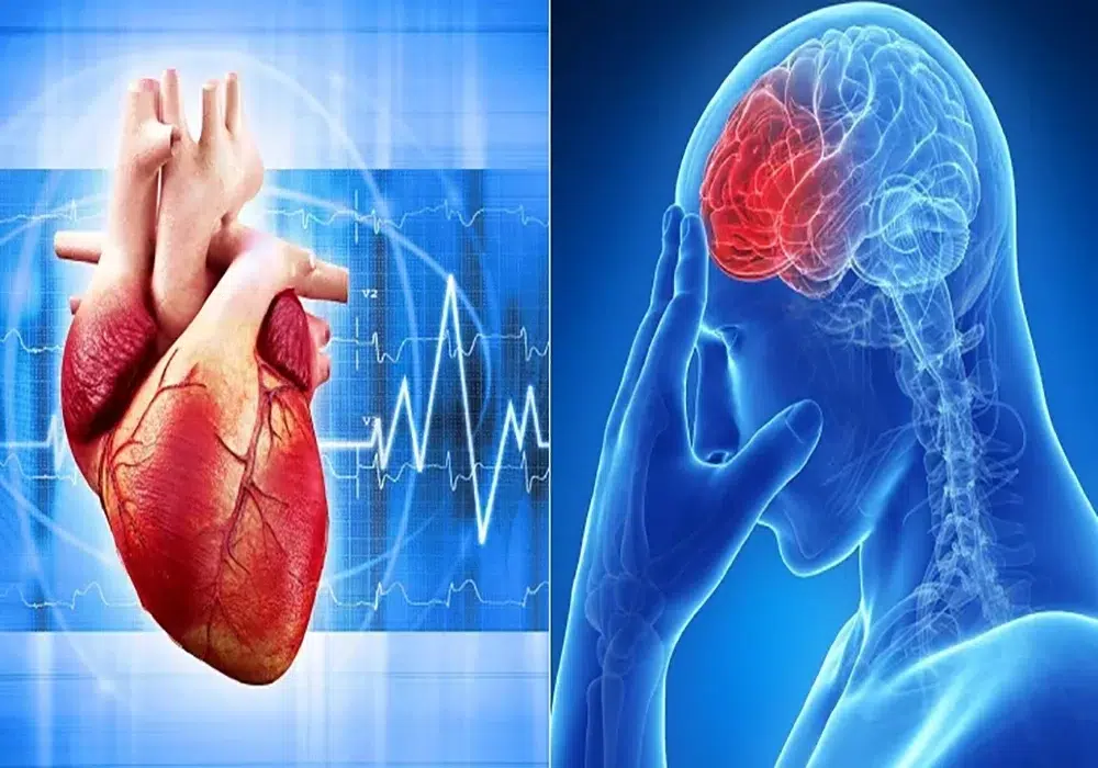 تفاوت حمله مغزی و حمله قلبی