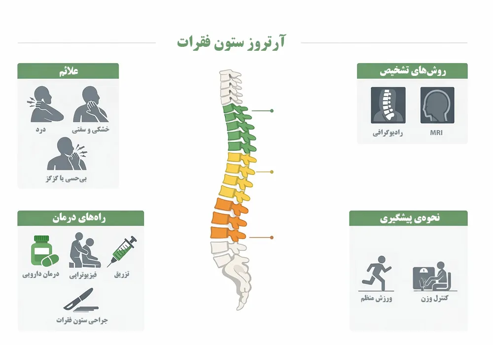 آرتروز ستون فقرات یا اسپوندیلوز