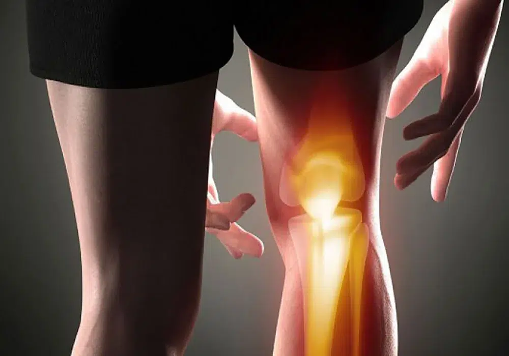 بهترین روش‌های پیشگیری از آرتروز و مراقبت از مفاصل