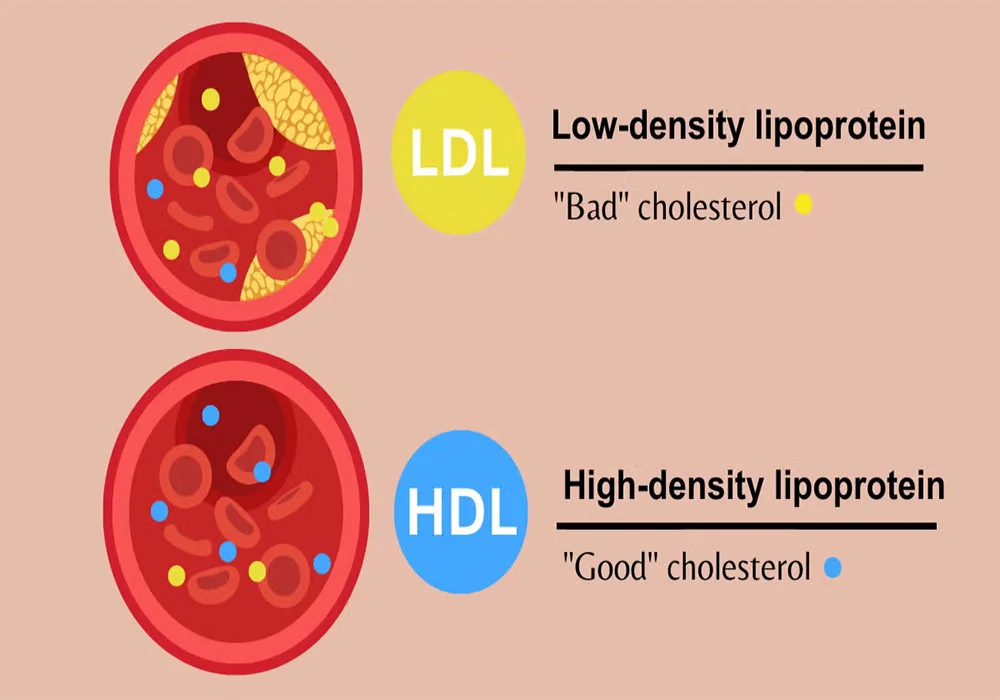 پیشگیری از کلسترول بالا