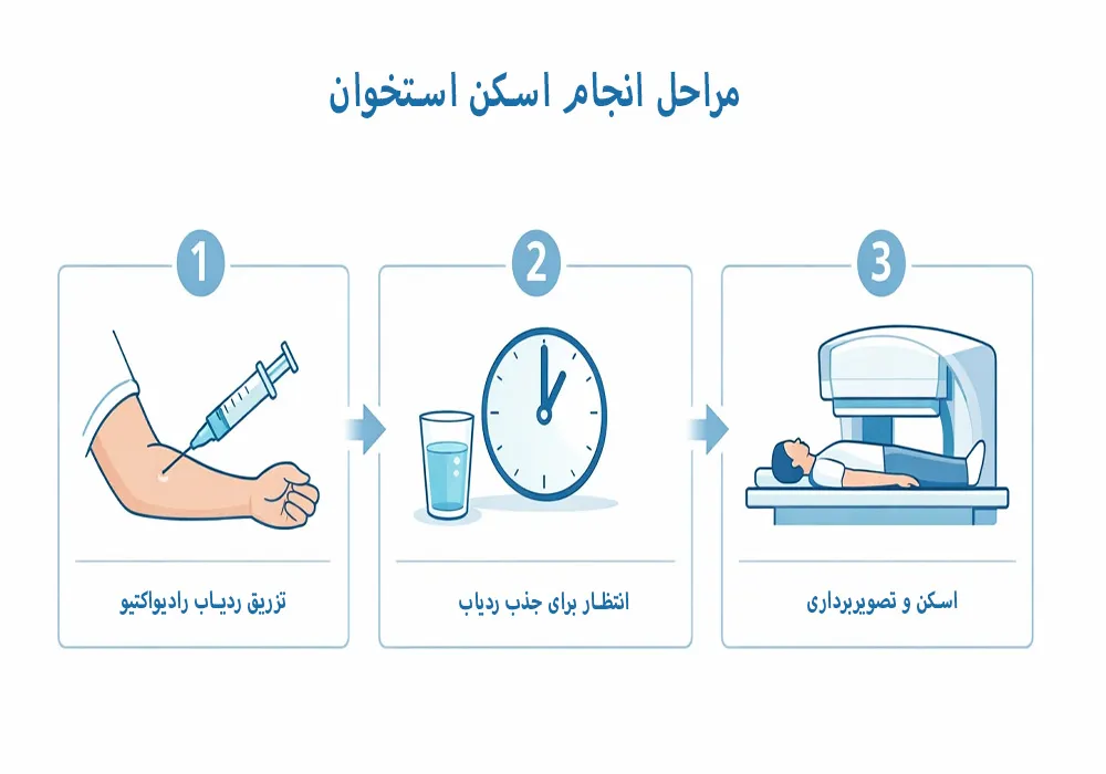 مراحل انجام اسکن استخوان