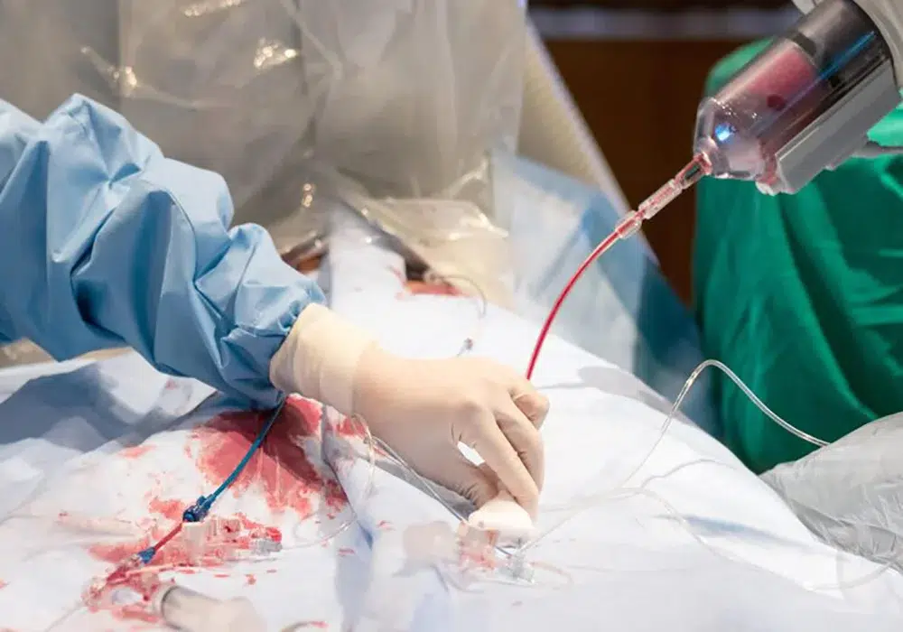 مراکز آنژیوگرافی قلب دولتی