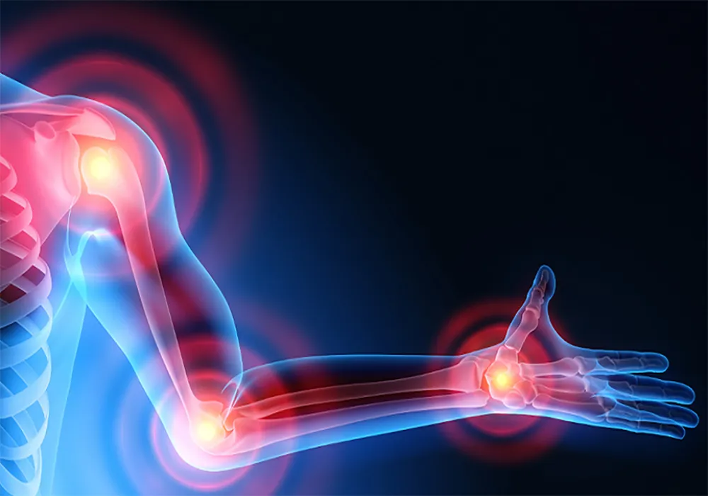 بهترین رژیم غذایی مناسب بیماران روماتیسمی | مواد غذایی مفید و مضر