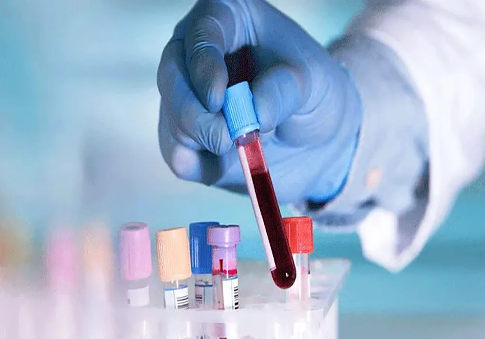 بهترین روش درمان غلظت خون چیست؟