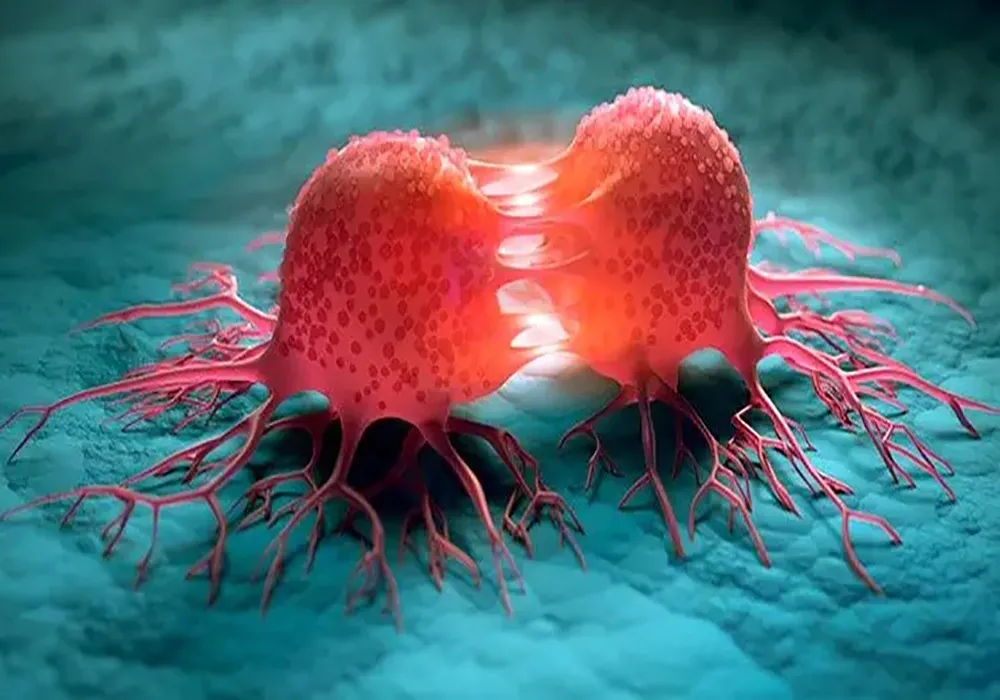 بهترین دکتر انکولوژی در تهران