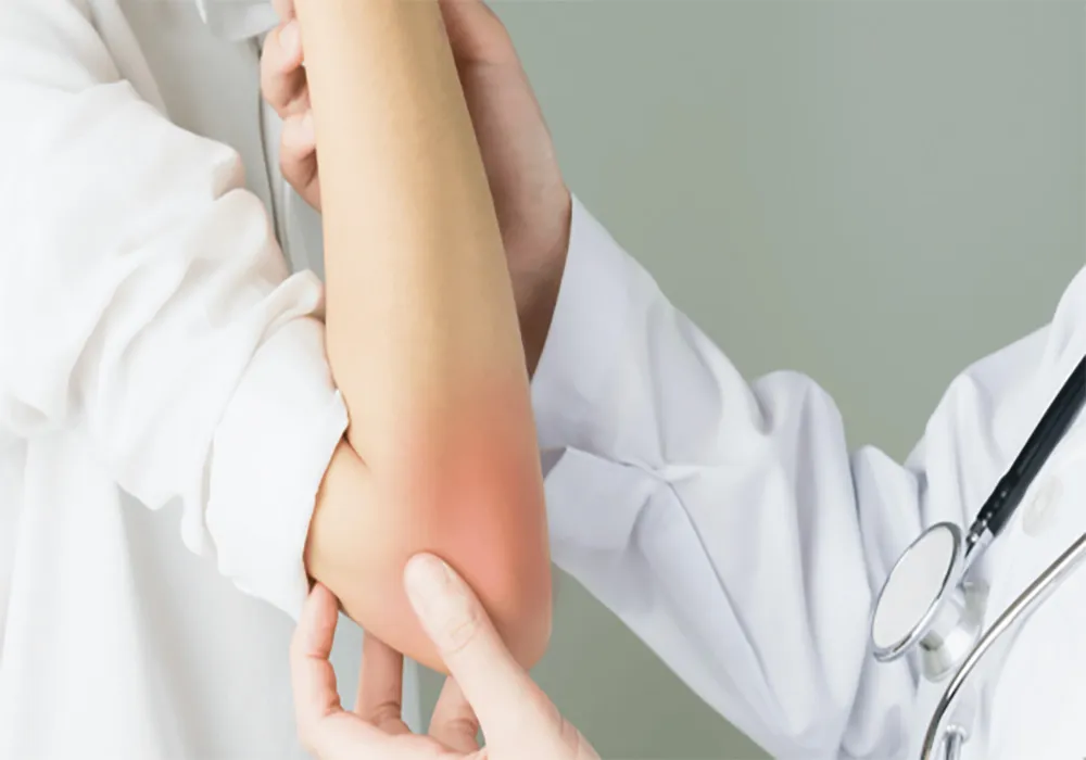 بیماری بهجت چیست؟ علائم ، راه های انتقال بیماری بهجت و درمان آن