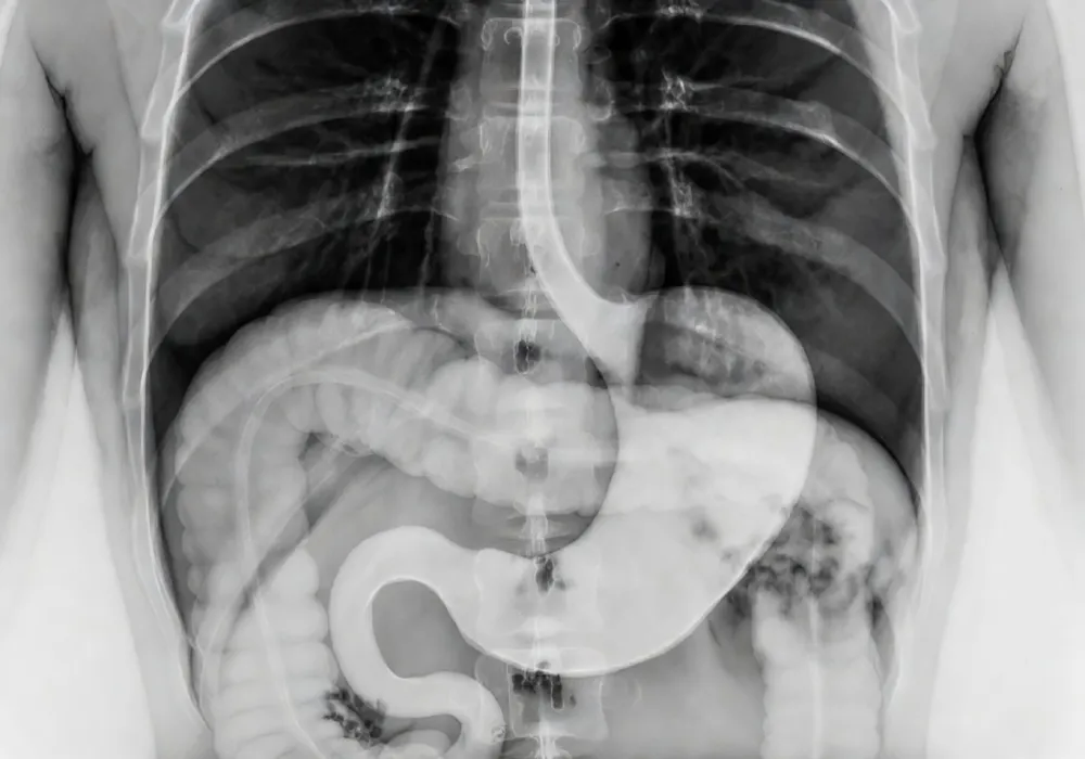 کاربرد فلوروسکوپی در تشخیص بیماری