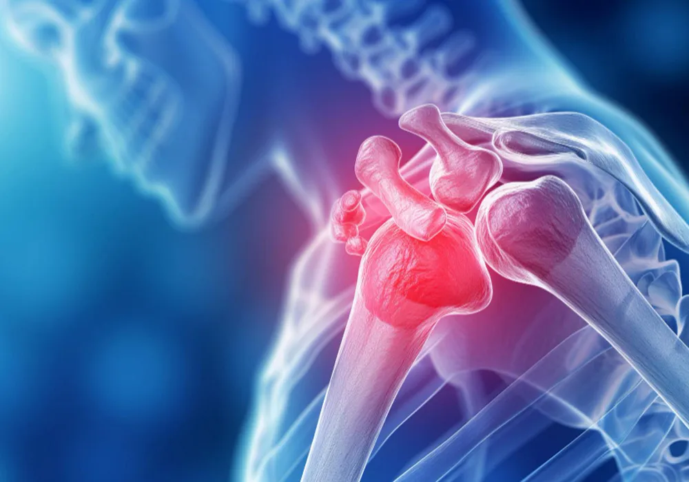 تومور استخوان