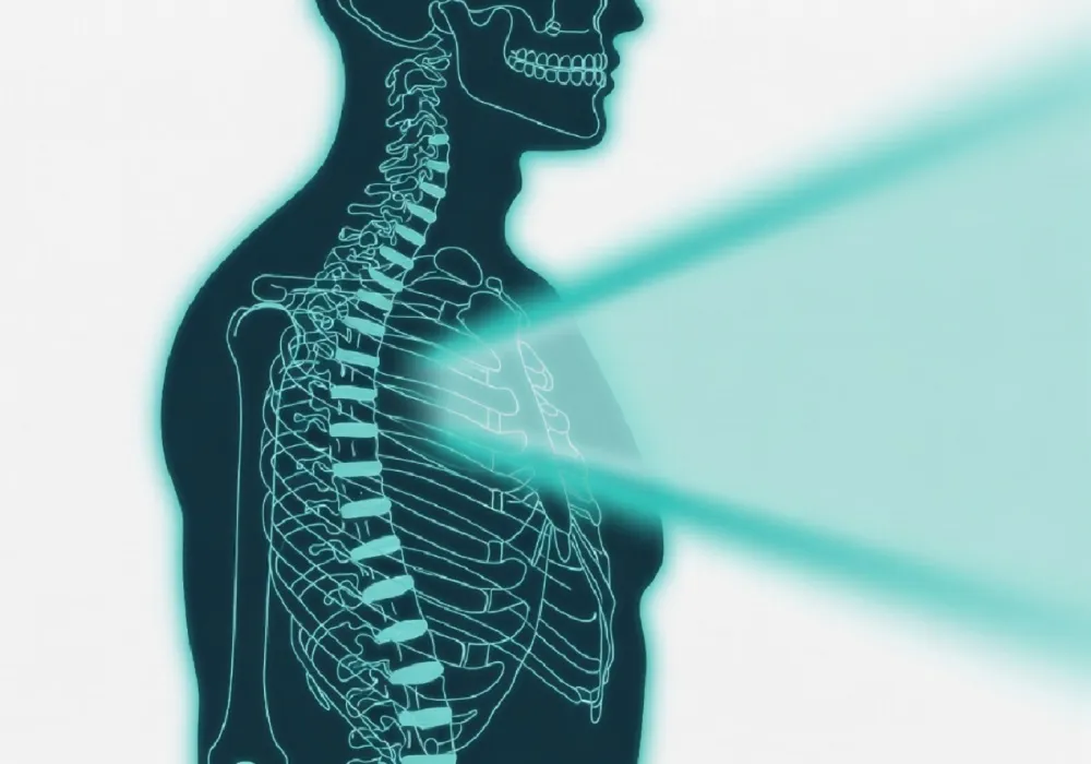 مضرات اشعه ایکس بر بدن