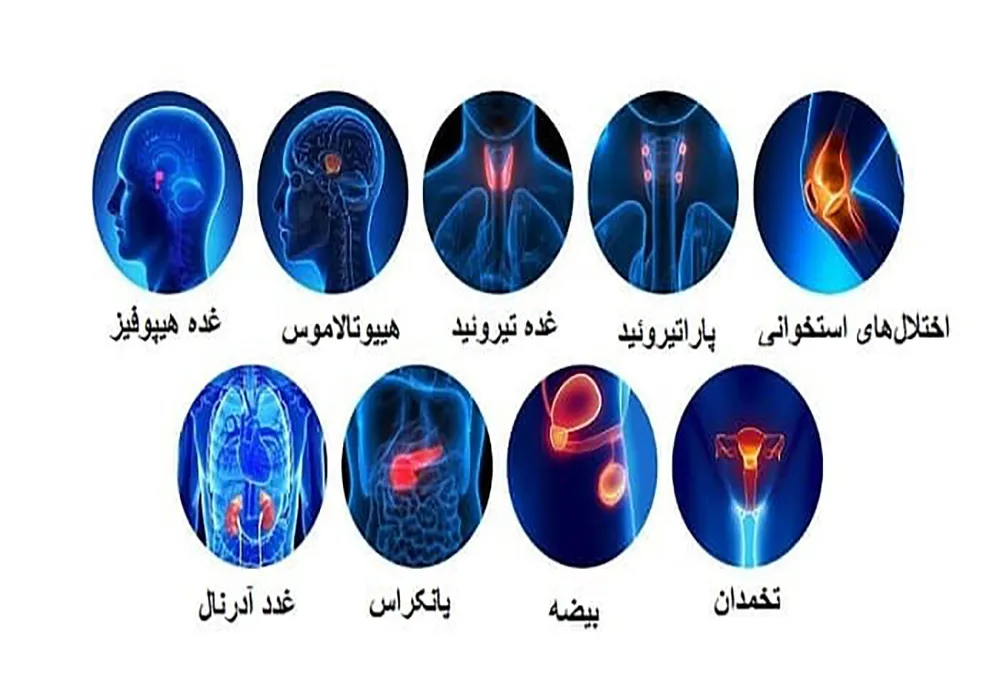 بهترین دکتر فوق تخصص غدد در تهران