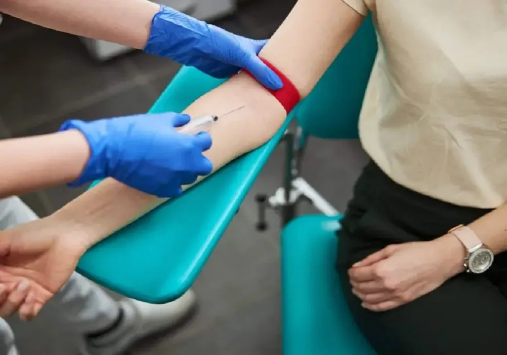 فلبوتومی یا فصد خون چیست؟ کاربرد، مزایا و نحوه انجام فلبوتومی درمانی