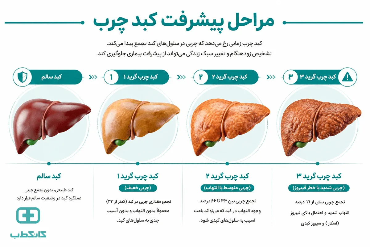 علت کبد چرب چیست