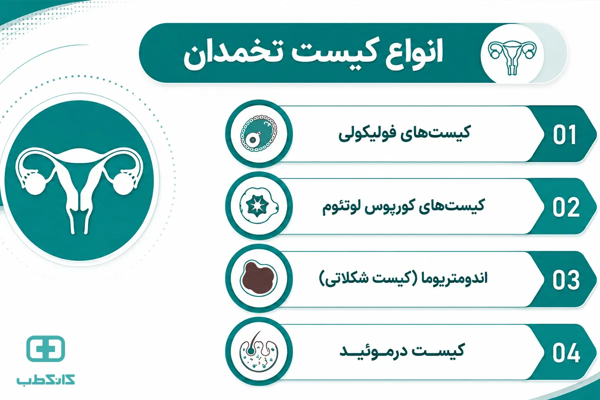 شایعترین علائم کیست تخمدان چیست