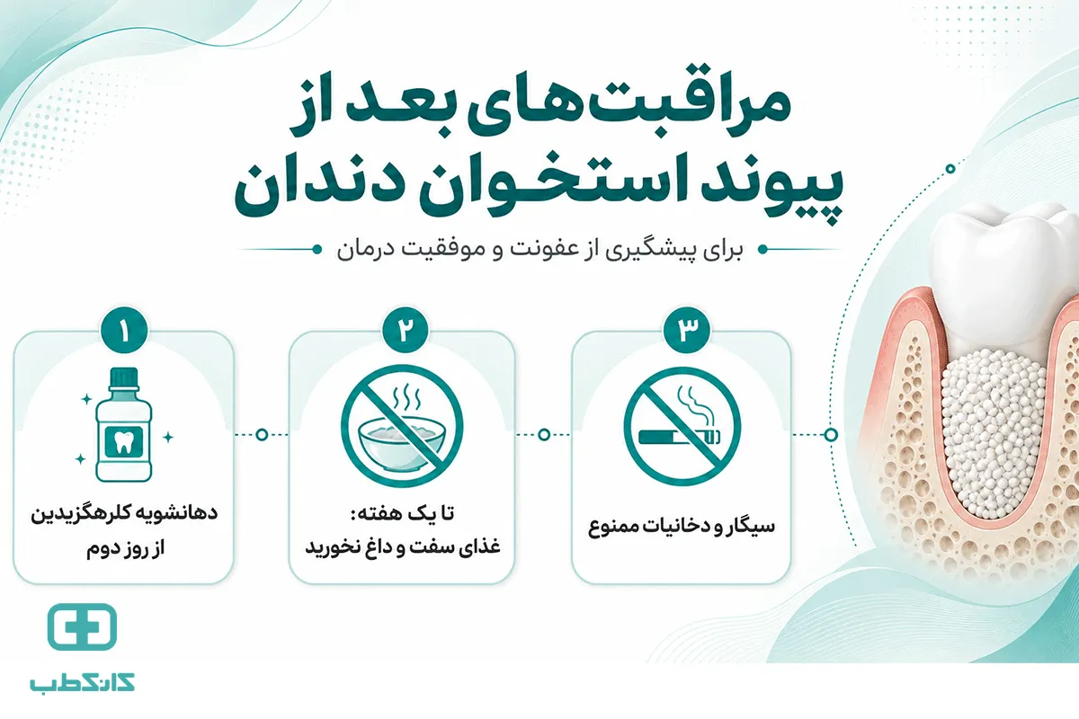 هزینه پیوند استخوان فک برای کاشت ایمپلنت